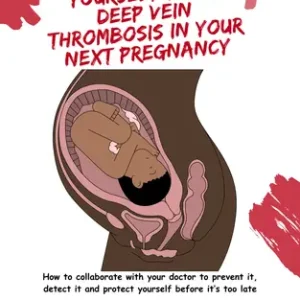 How to Protect Yourself from Deep Vein Thrombosis in Your Next Pregnancy